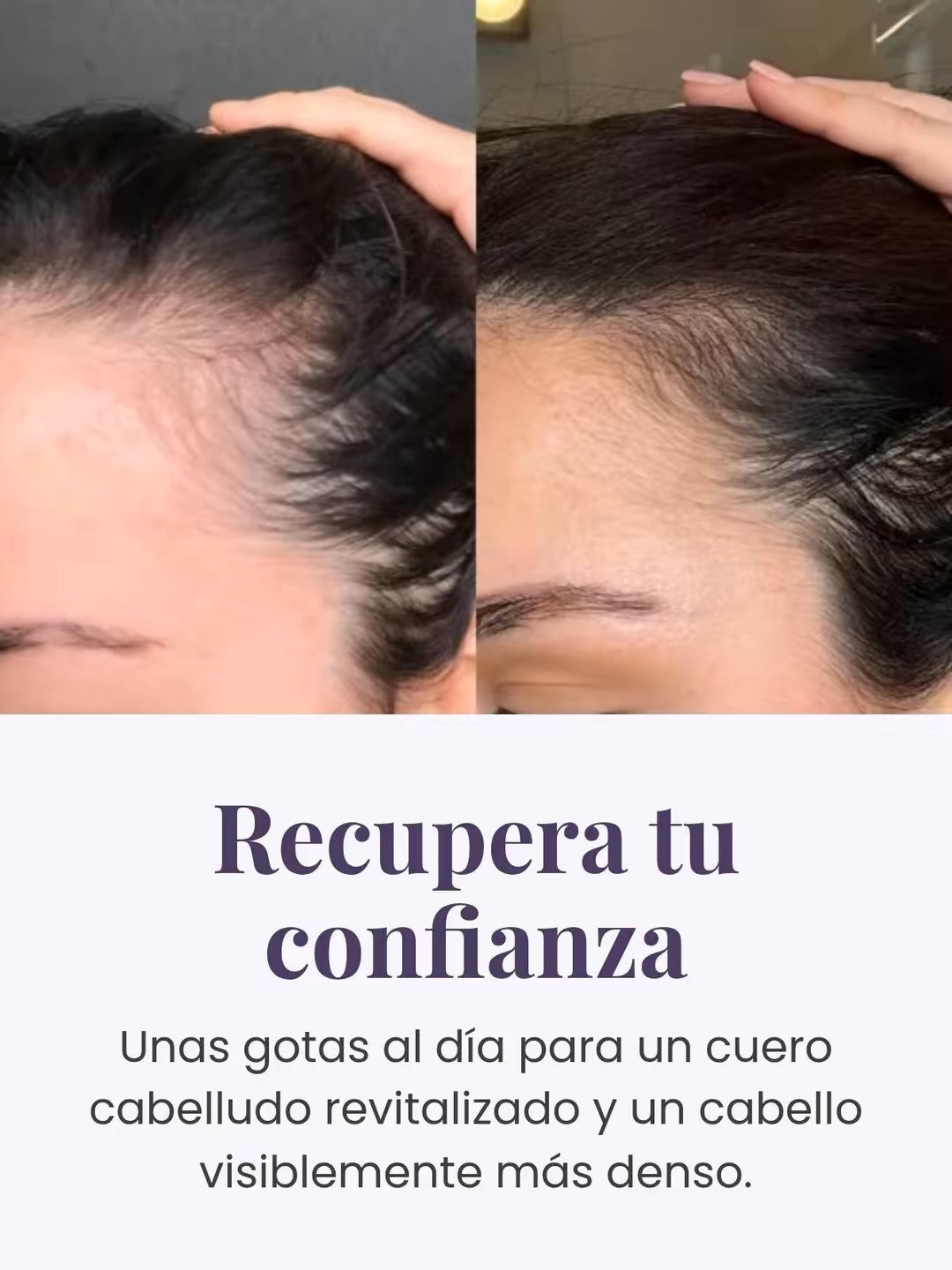 Scalp Treatment
